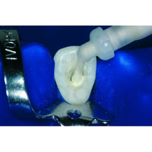 Ivoclar Apexit Plus - Apexcal Promo Pack Buy Dental products Online DentalMyntra