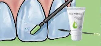 Ivoclar Fluor Protector Gel Buy Dental products Online DentalMyntra