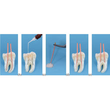 Meta CeraSeal RC Sealer Buy Dental products Online DentalMyntra