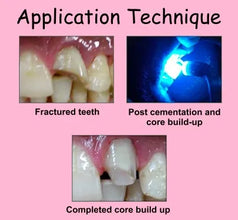 Prevest Fusion Core Dc Flo (9gm) Buy Dental products Online DentalMyntra