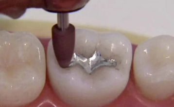 Shofu Amalgam Polishing Kit Fg/Ca Buy Dental products Online DentalMyntra