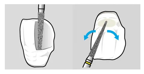 Shofu Direct Cosmetic Restoration Kit Buy Dental products Online DentalMyntra