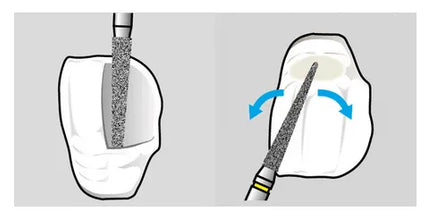 Shofu Direct Cosmetic Restoration Kit Buy Dental products Online DentalMyntra