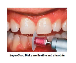 Shofu Super Snap Mini Kit CA Buy Dental products Online DentalMyntra