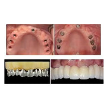 Multi Abutment (Straight)