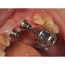 Cementable Abutment (Regular)