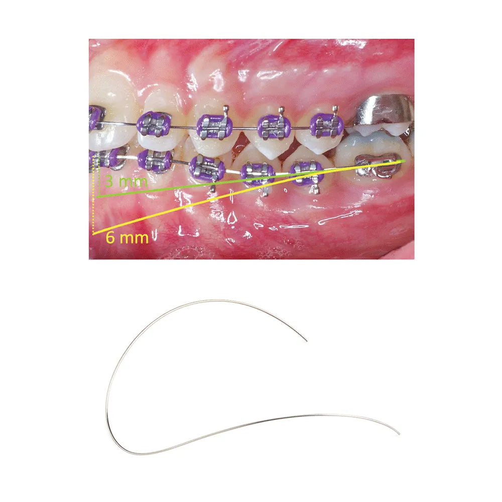 AZDENT Niti Reverse Curve Rectangular Arch Wire – Dental Orthodontic Elastic