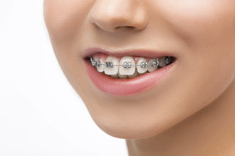 3m Unitek Victory Series Low Profile Brackets Buy Dental products Online DentalMyntra