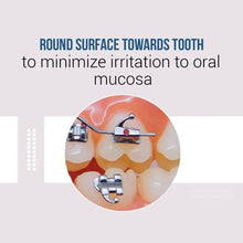 Ortho Premium Bondable Buccal Tubes MBT(Pack of 20)