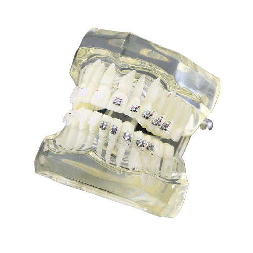 Orthodontic Education Model Half Metal & Ceramic