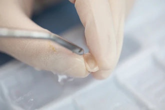Vincismile HF-Etchant Hydrofluoric Acid Etching Gel