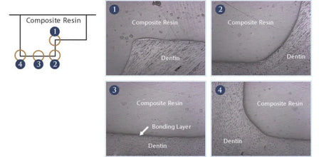 Tokuyama Palfique 7th Generation Bond 5ml