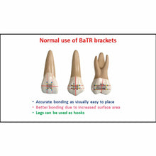 BaTR MBT Metal Brackets with Variable Torque & Rotation