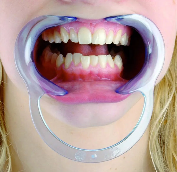 Cotisen Cheek Retractor C Type Small Pk/2 Buy Dental products Online DentalMyntra