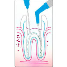 Cotisen Endodontic Aspirator Tip | Flexible Root Canal Suction