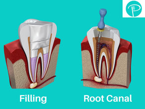 Medicept Bio Fill Root Canal Filling Material