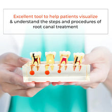 DENTical Study Model Root Canal Treatment M 4018 Buy Dental products Online DentalMyntra