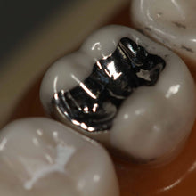 DPI Fine Grain Silver Alloy | Dental Amalgam | 15g & 30g