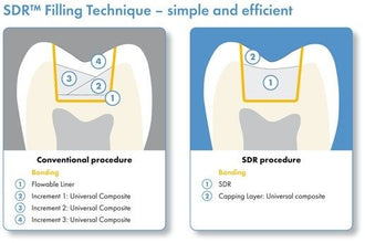 Dentsply SDR Flowable Bulk Filling Material Buy Dental products Online DentalMyntra
