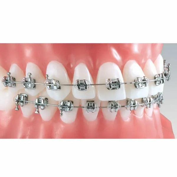 ET Dental MBT 022 Mini Brackets Kit – Non-Extraction 