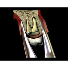 GDC Extraction Forceps Upper Roots - 29 Standard Buy Dental products Online DentalMyntra