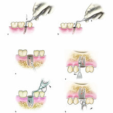 GDC Root Elevators | Stainless Steel Dental Tooth