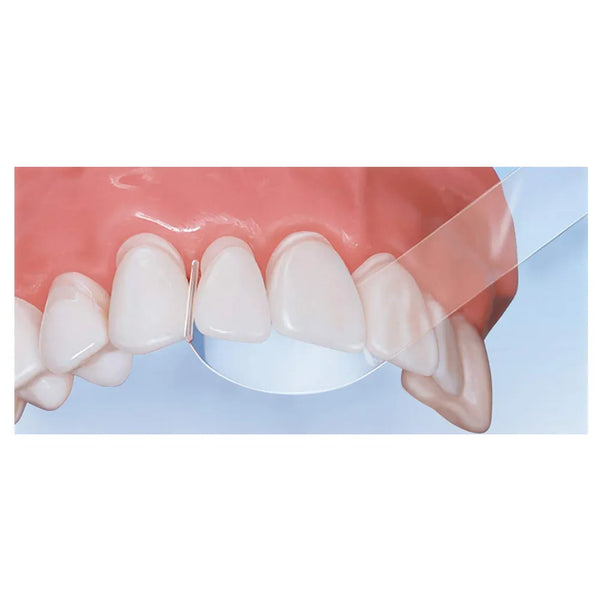 Gi Matrix GI Dental Matrix Strips Straight – Dentalmantraa
