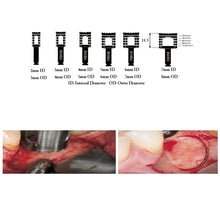 Julldent Trephine Drills Refills Buy Dental products Online DentalMyntra