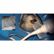 Meta CeraSeal RC Sealer - Bioceramic Root