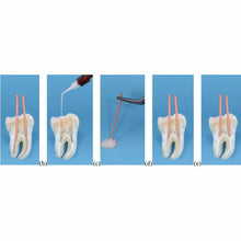 Meta CeraSeal RC Sealer - Bioceramic Root