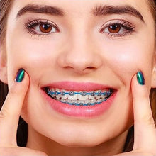 OrthoMetric E-Chain 15 Ft Buy Dental products Online DentalMyntra