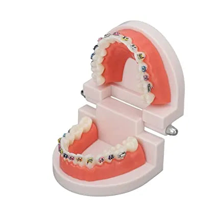 Patient Education Model With Orthodontic Brackets