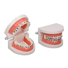 Patient Education Model With Orthodontic Brackets Buy Dental products Online DentalMyntra