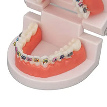 Patient Education Model With Orthodontic Brackets Buy Dental products Online DentalMyntra