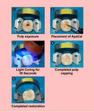 Prevest ApaCal ART Buy Dental products Online DentalMyntra