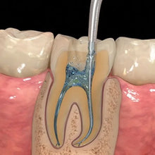 Prevest Chlor X Buy Dental products Online DentalMyntra