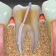Prevest Zical Automix Buy Dental products Online DentalMyntra