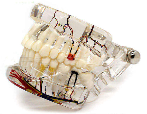 All-in-One Dental Model with Nerves, Caries & Implants