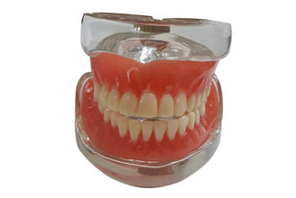 Over Denture Model