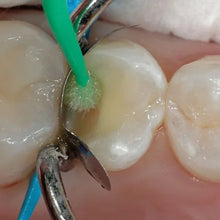 Prevest Renew Universal Dental Adhesive Regular Pack