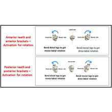 MBT Metal Bracket  BaTR- Brackets with Variable Torque and Rotation