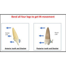 MBT Metal Bracket  BaTR- Brackets with Variable Torque and Rotation