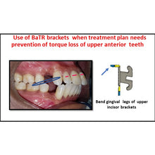 MBT Metal Bracket  BaTR- Brackets with Variable Torque and Rotation