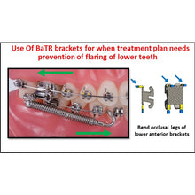 MBT Metal Bracket  BaTR- Brackets with Variable Torque and Rotation