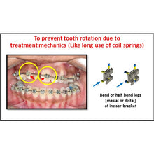 MBT Metal Bracket  BaTR- Brackets with Variable Torque and Rotation