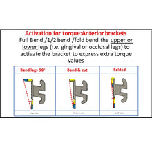 MBT Metal Bracket  BaTR- Brackets with Variable Torque and Rotation