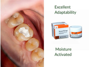 SmartTemp Temporary Dental Filling –