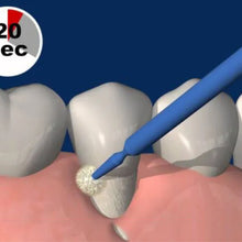 TOKUYAMA SHIELD FORCE PLUS - Glass Ionomer Cement