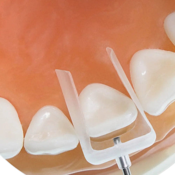 IVeneer Injectable Composite for Aesthetic Restorations