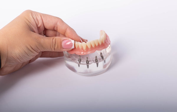 4 Implant Dental Training Jaw Model for Implant Practice